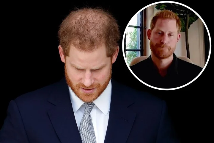 prince harry hair